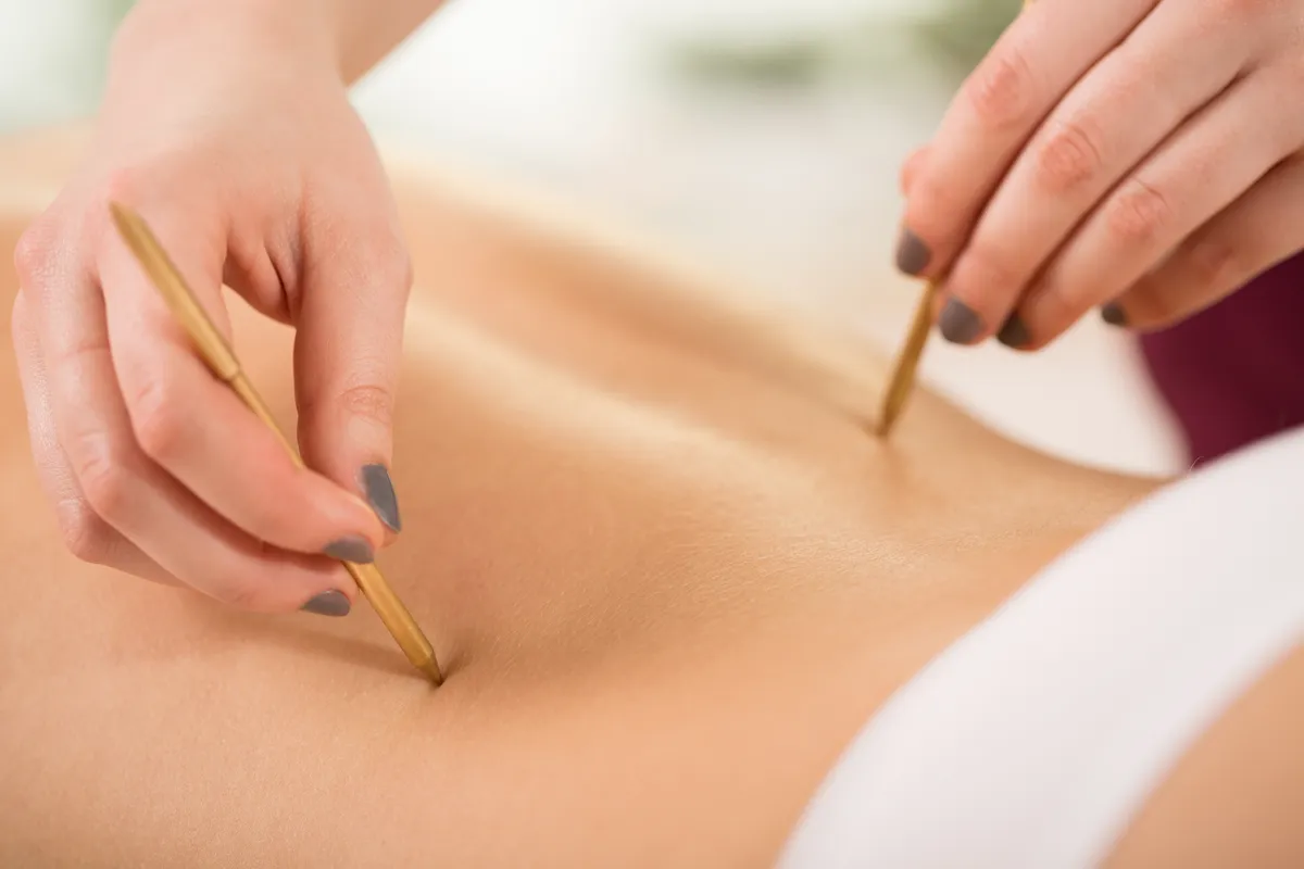 Close-up of woman relaxing during acupuncture session
